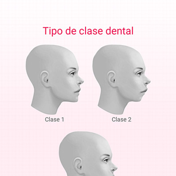 EptaMed — Ortodoncia Postural — progetto Contat — anteprima
